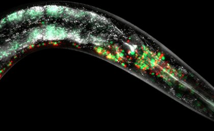 Mitochondria labelled by fluorescent red, and green proteins in the neurons.